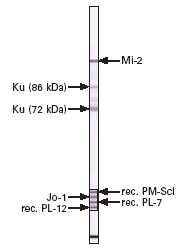 myositisEurolineWB