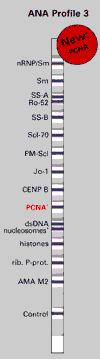 ana_eurolineProfile3_small