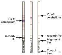 neuronalAntigens_WB