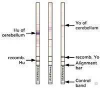 neuronalAntigens_WB