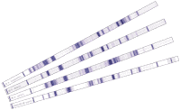 http://www.biognost.be/pictures/cms1/westernBlot.gif